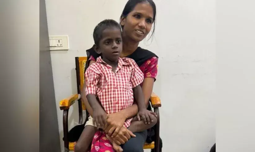 Hyderabad: Osmania Hospital performs liver transplant surgery on 3-year-old boy