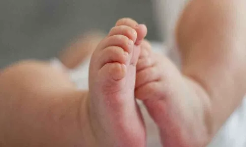 Baby undergoes rare heart surgery 3 hours after birth at KIMS Kurnool
