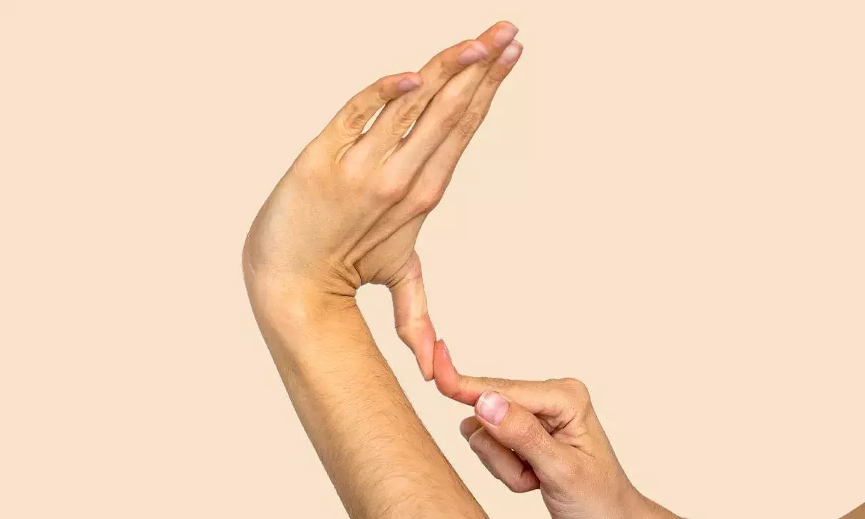 Marfan syndrome: Woman, 18-year-old successfully operated in Hyderabads Kamineni Hospital