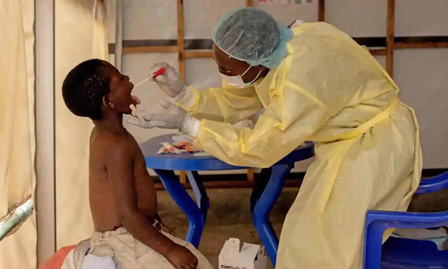 Only 6% Indians concerned about Mpox: LocalCircles survey