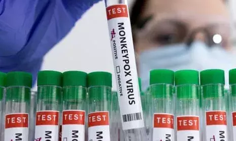 Andhra Pradesh CM launches indigenous Monkeypox RT-PCR kit