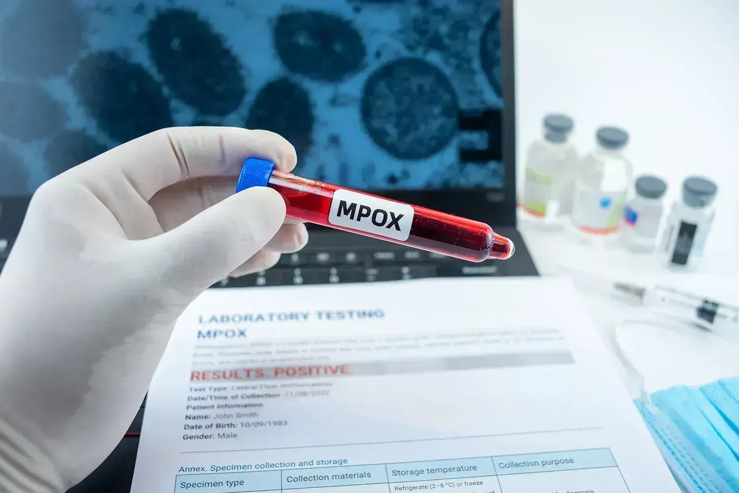 First Mpox case confirmed in India, Centre advises states to screen; test all suspect cases First Mpox case confirmed in India, Centre advises states to screen; test all suspect cases