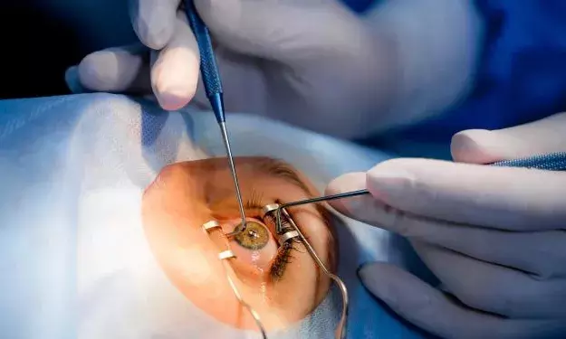 LV Prasad Eye Institute in Hyderabad sets world record with 50,000 corneal transplants
