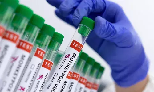 Govt asks states to identify facilities, trained human resources to handle mpox cases
