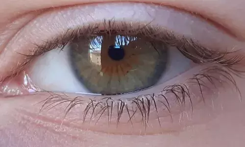 What is Corneal blindness? Why 6.8M people in India suffer from this disorder