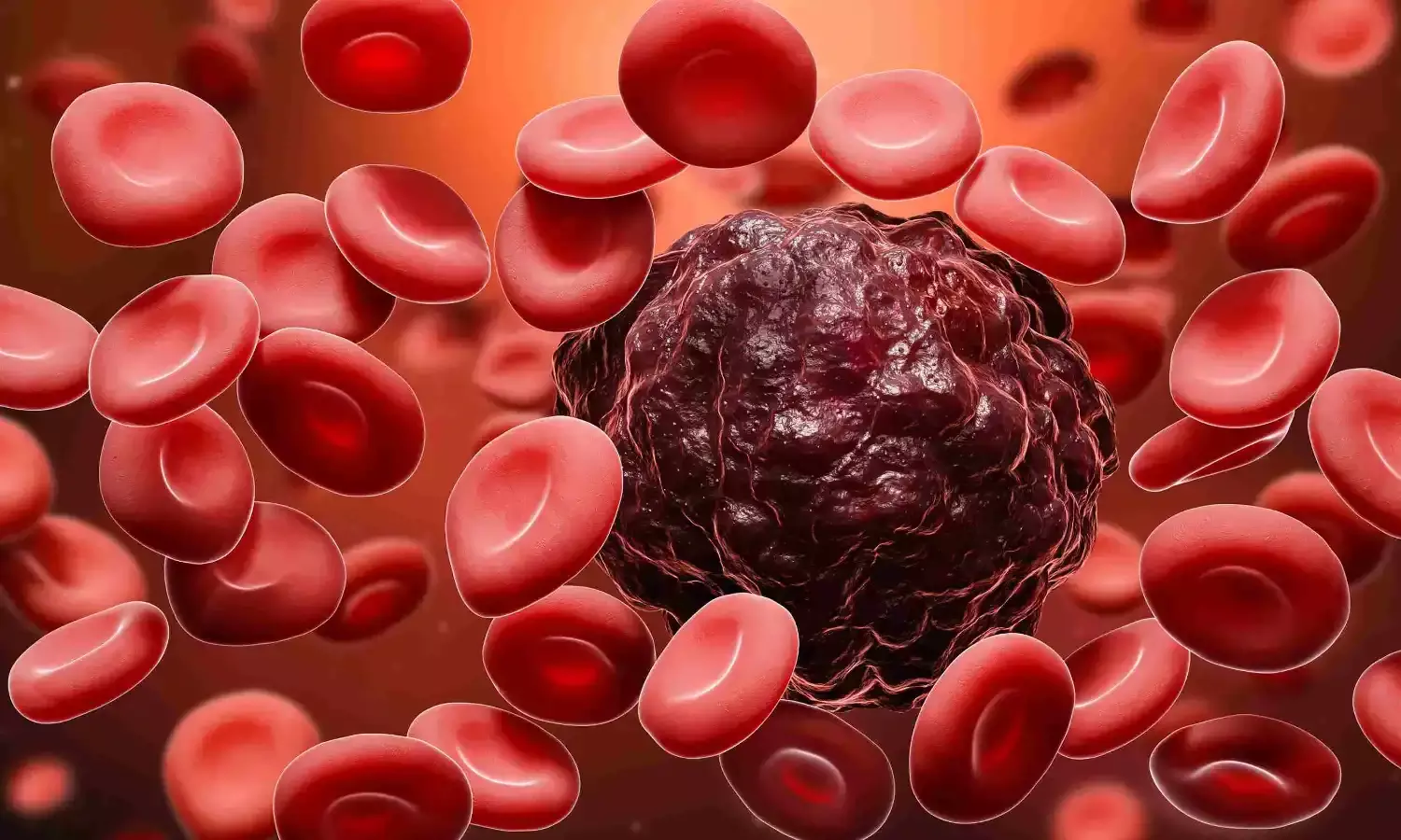 Explainer: How CAR-T cell therapy engineers immune cells to treat cancer