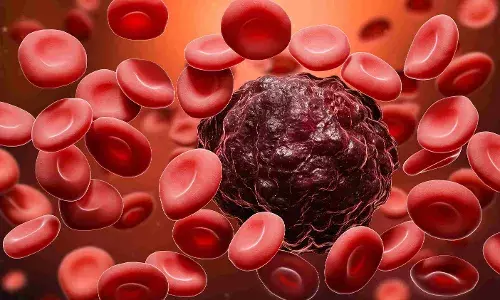 Explainer: How CAR-T cell therapy engineers immune cells to treat cancer