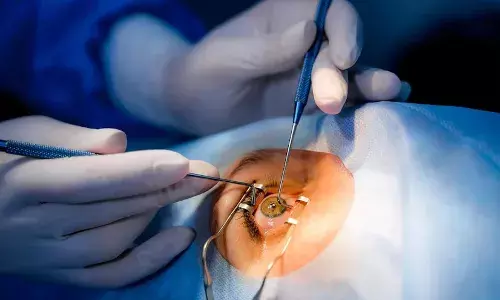 Hyderabad: Oriental Insurance fined Rs 67,500 for denying complete coverage for cataract surgery