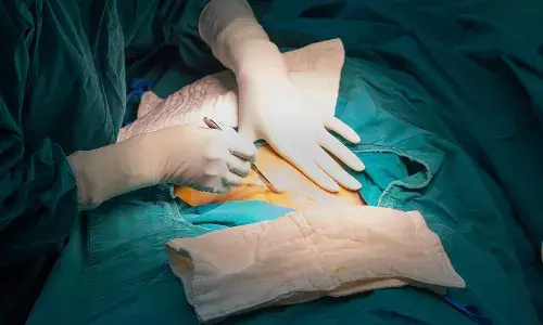 Cesarean deliveries: With 60.7%, Telangana ranks first in India; AP third