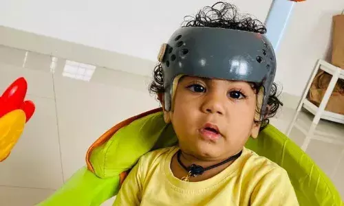 Rare surgery performed on newborn with fused skull at Kamineni Hospital in LB Nagar