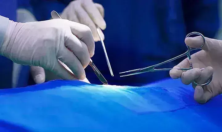 Surgical infection rate higher in India than many high-income countries: ICMR Study