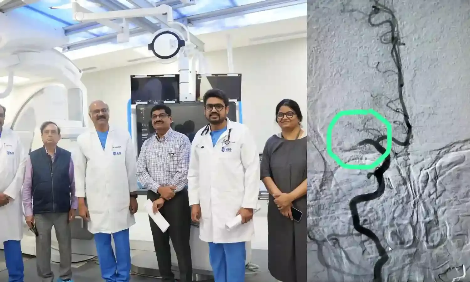 Hyderabad: AIG Hospitals launches state-of-the-art NeuroCath Lab to tackle stroke emergencies