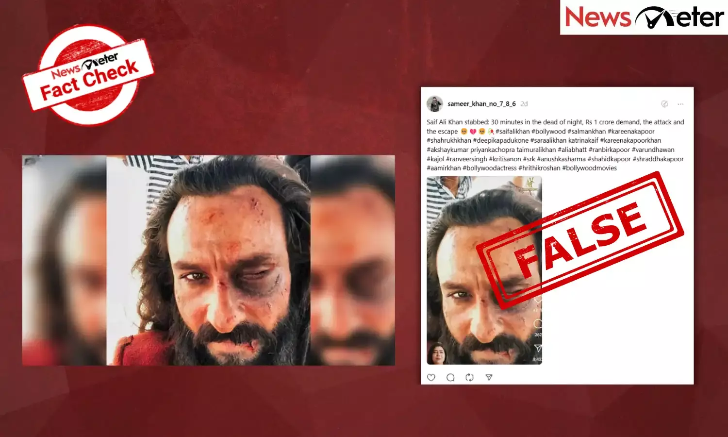 Fact Check: Saif Ali Khan’s face, eye injured during knife attack? Here’s truth behind viral photo