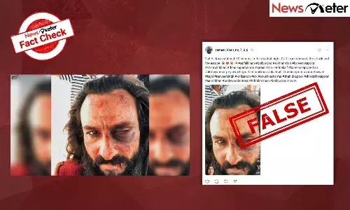 Fact Check: Saif Ali Khan’s face, eye injured during knife attack? Here’s truth behind viral photo