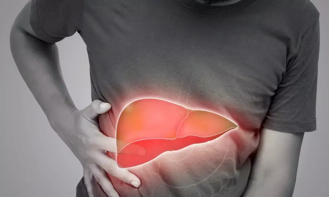 UoH study: 84% of Indian techies suffer fatty liver disease due to sedentary work, stress