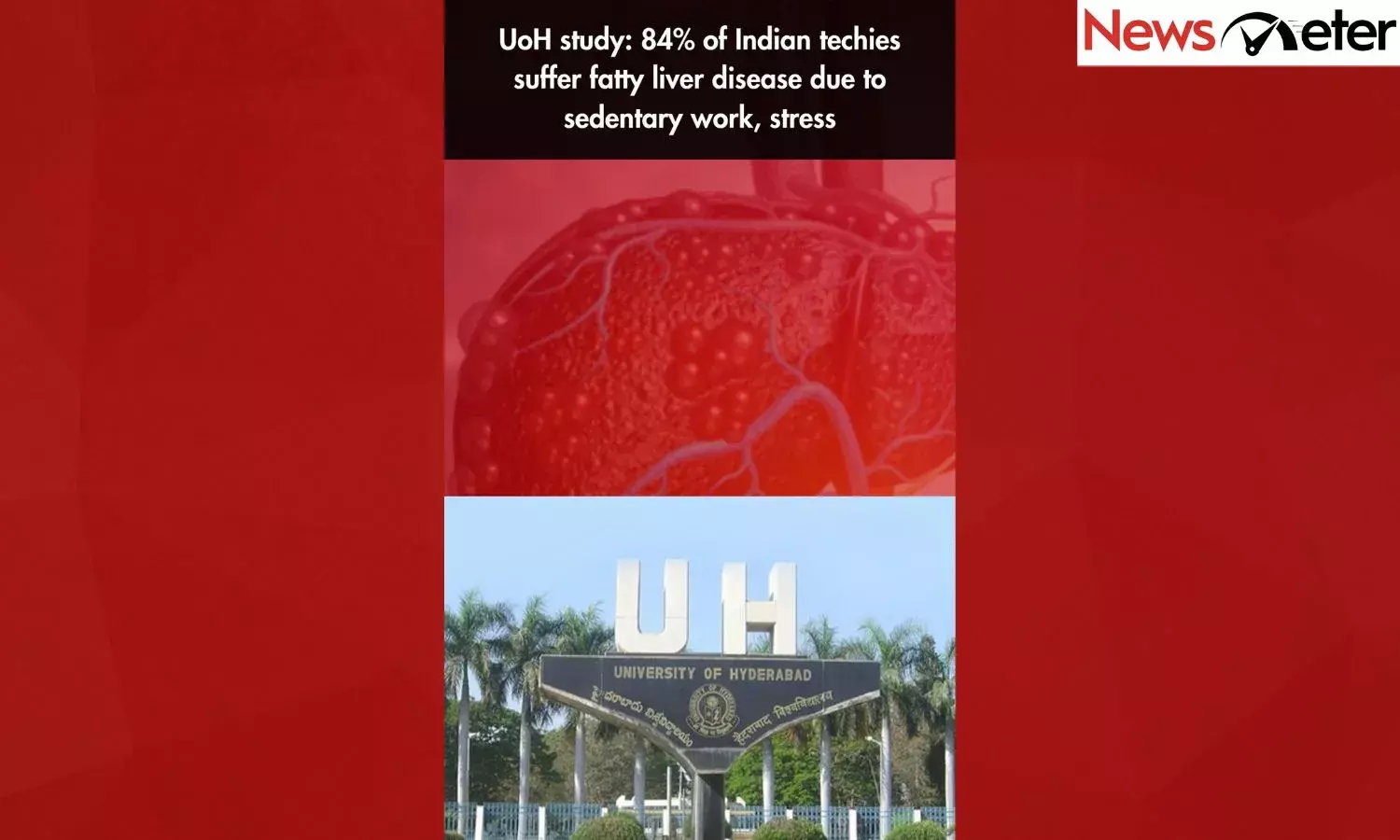 UoH study: 84% of Indian techies suffer fatty liver disease due to sedentary work, stress