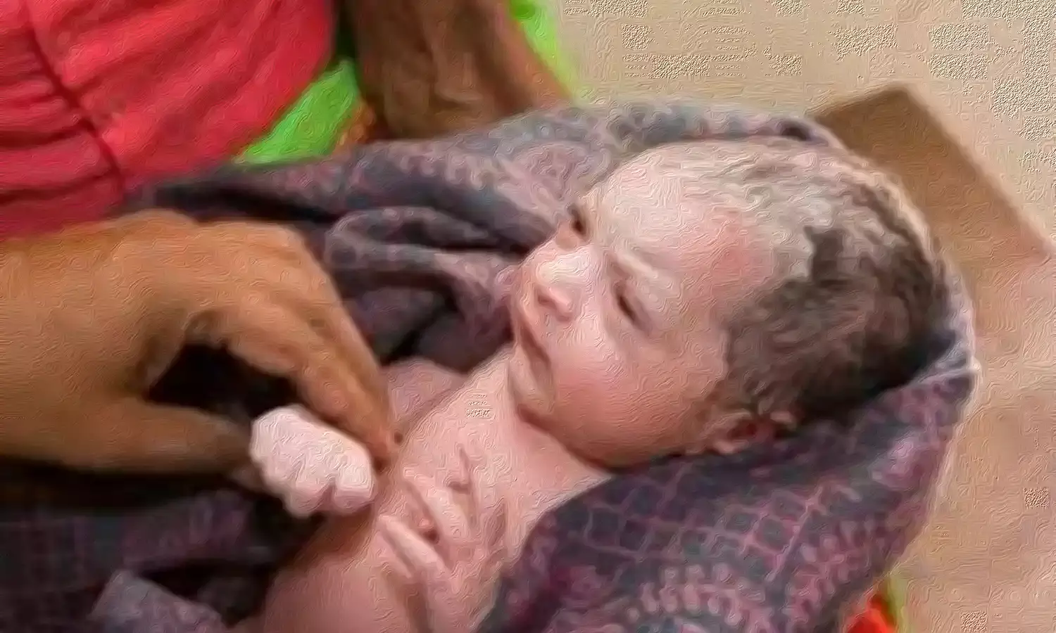 World Birth Defects Day: Over 1.7 billion babies born with birth defects in India every year