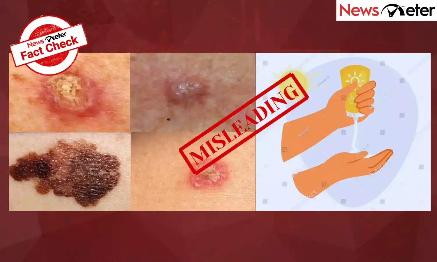 Fact Check: Sunscreen causes skin cancer? Find the facts here