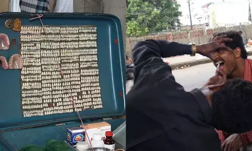 Inflamed gums, lost teeth: The hidden dangers of unqualified dentists in Hyderabad