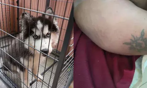 Hyderabad: Man found dead at Madhura Nagar; body bore dog bite marks