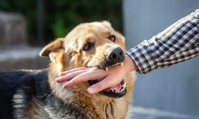 Hyderabad: Bank credit card recovery executive injured after customer sets dog on him; case registered