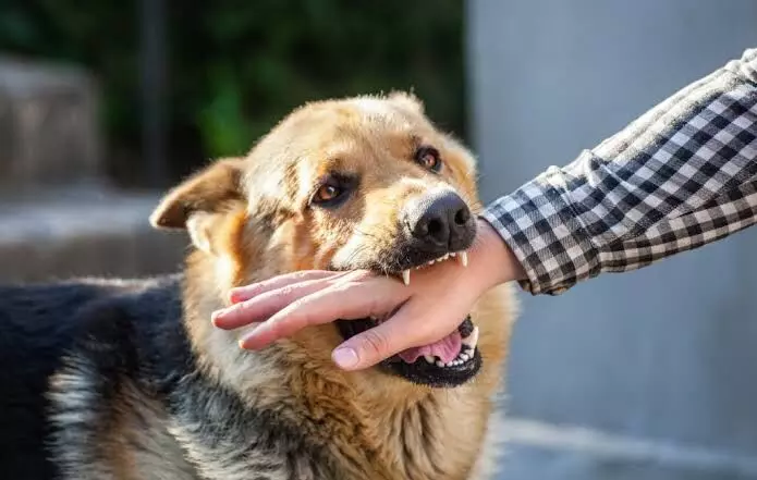Hyderabad: Bank credit card recovery executive injured after customer sets dog on him; case registered Hyderabad: Bank credit card recovery executive injured after customer sets dog on him; case registered