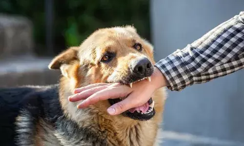 Hyderabad: Bank credit card recovery executive injured after customer sets dog on him; case registered