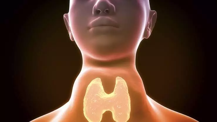 KIMS Kondapur doctors remove massive goiter pressing chest in high-risk surgery KIMS Kondapur doctors remove massive goiter pressing chest in high-risk surgery