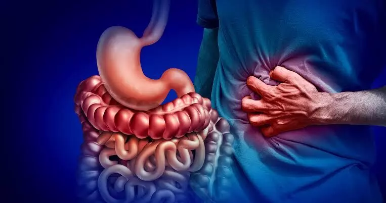 World Inflammatory Bowel Disease Day: Here are some tips to reset gut health World Inflammatory Bowel Disease Day: Here are some tips to reset gut health