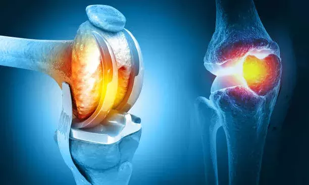 Advanced knee surgeries: KIMS ICON Vizag doctors restore mobility in two obese patients