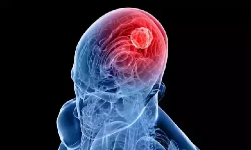Glioblastoma Awareness Day: India reports 23,000 cases daily; urgent need for early diagnosis, research