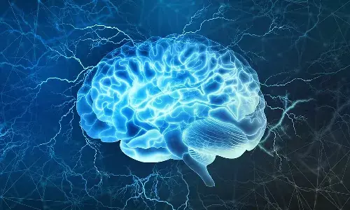 4 Pillars of Brain Health: Sleep, nutrition, activity and lifestyle