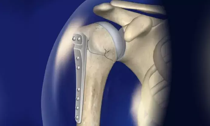 Rare surgery on Khammam man with fractures in both shoulder joints done at Renova Hospitals