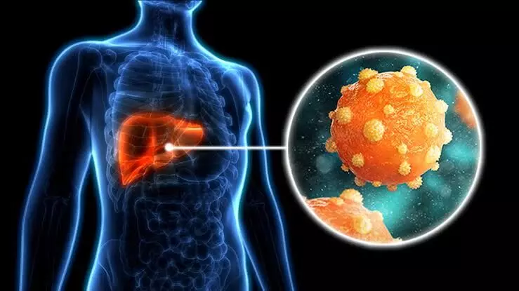 World Hepatitis Day: How vaccinations can prevent Hepatitis A and B infections World Hepatitis Day: How vaccinations can prevent Hepatitis A and B infections