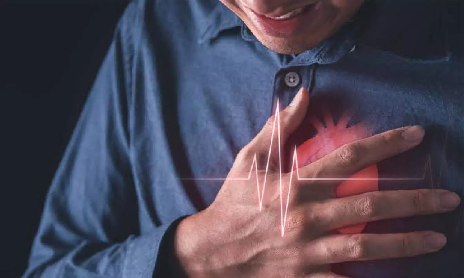 Over 45% of heart attacks go unnoticed in India Over 45% of heart attacks go unnoticed in India