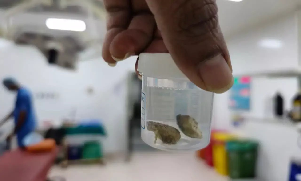 Hyderabad: How Robo-Lap 2025 provided a platform to 1000 global doctors to discuss robotics in urology