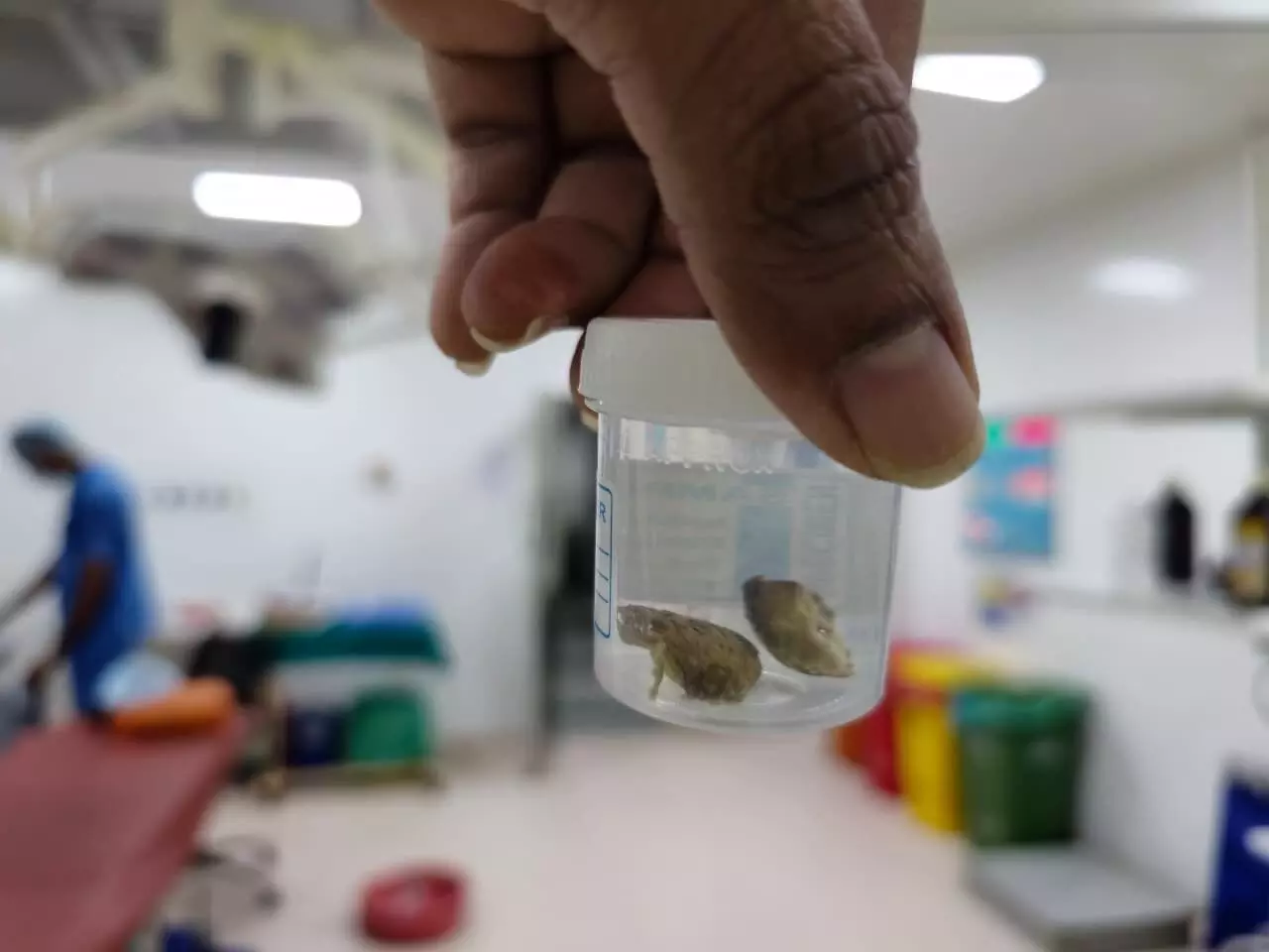 Hyderabad: How Robo-Lap 2025 provided a platform to 1000 global doctors to discuss robotics in urology Hyderabad: How Robo-Lap 2025 provided a platform to 1000 global doctors to discuss robotics in urology