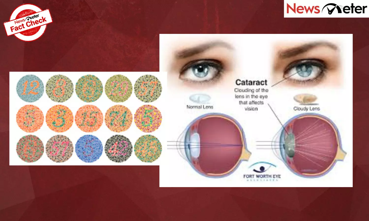 Common eye myths debunked: From colour blindness to cataracts Common eye myths debunked: From colour blindness to cataracts