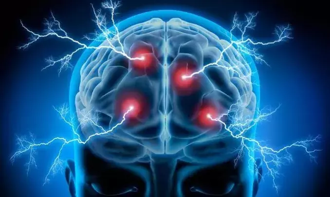 World Stroke Day: How creativity and practising art become a lifeline and symbol of recovery