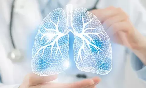 World Pneumonia Day How prolonged exposure to polluted air fuels the disease