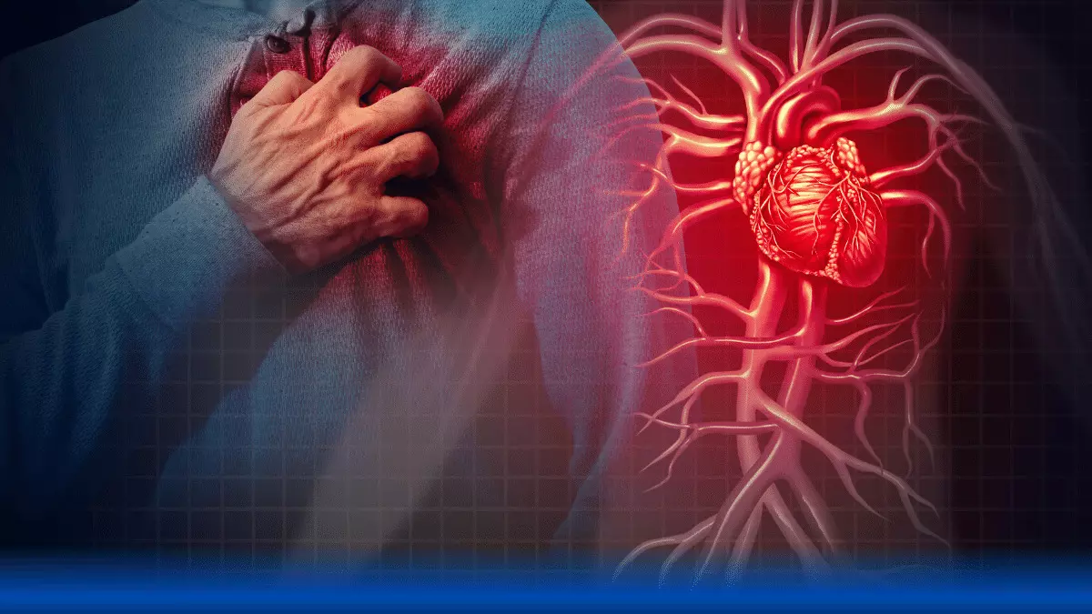 Cardiogenic shock: Timely intervention of docs at Care Hospitals, Malakpet, saves patients life