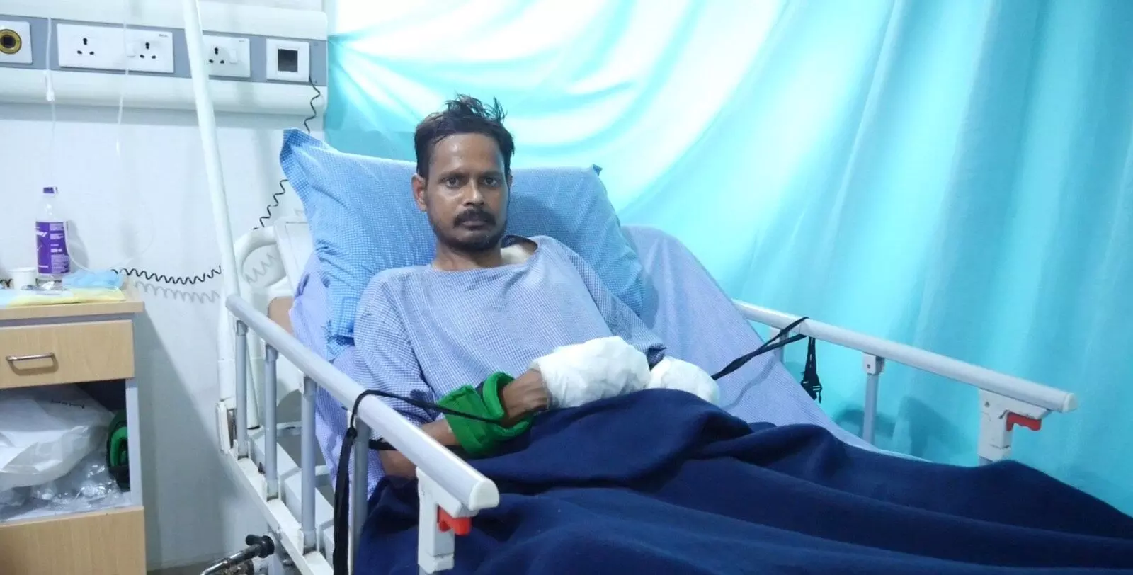 Construction worker survives iron-rod impalement after fall; timely surgery at Amor Hospitals saves his life Construction worker survives iron-rod impalement after fall; timely surgery at Amor Hospitals saves his life