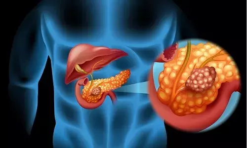 Two-stage treatment at KIMS Kondapur saves techie with pancreatic neuroendocrine tumour