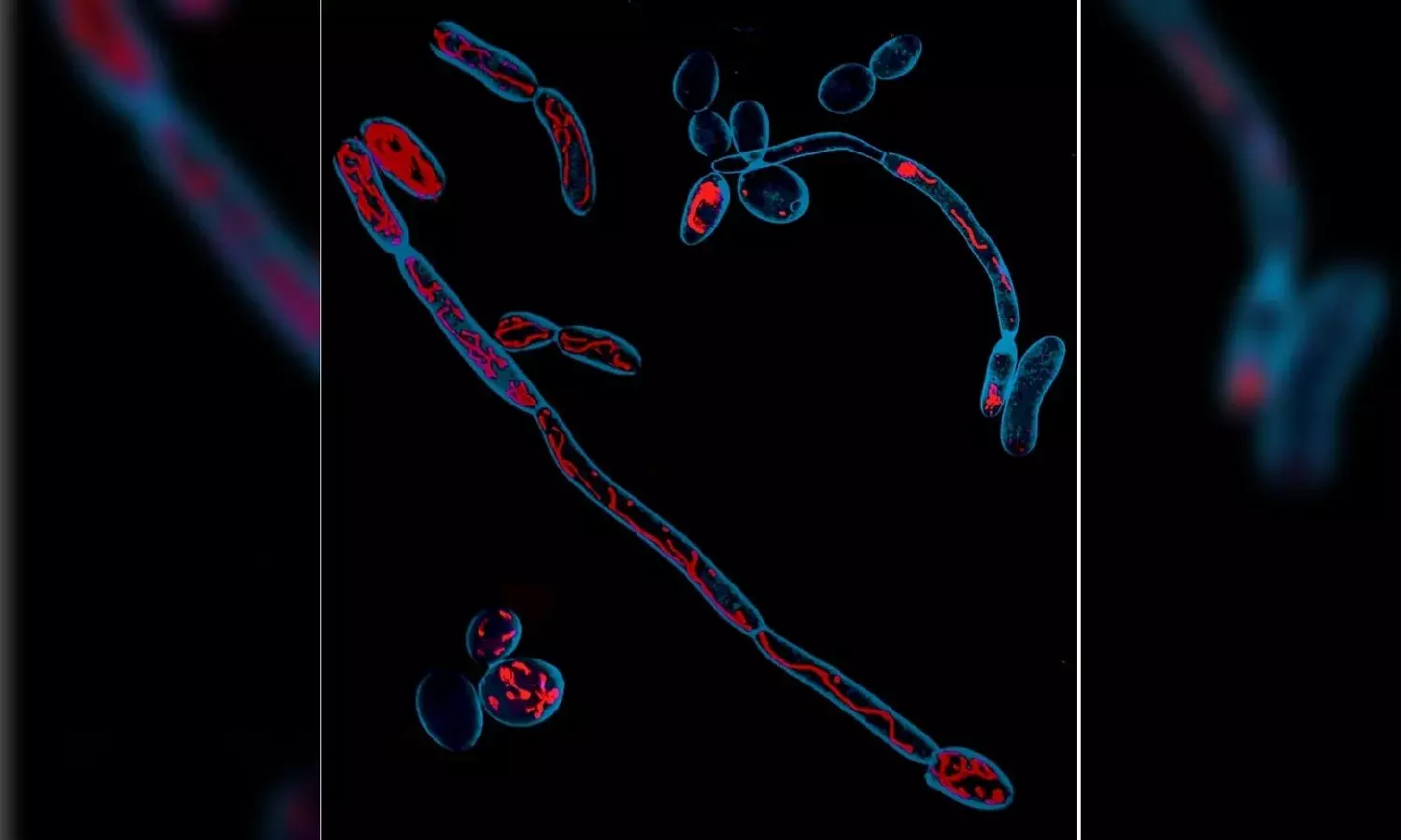 How to stop dangerous fungal infections? Researchers at CSIR-CCMB, Hyderabad have answers