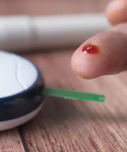 What is dyslipidaemia? Why 70% of Hyderabadis tested have abnormal fat levels in blood? What is dyslipidaemia? Why 70% of Hyderabadis tested have abnormal fat levels in blood?