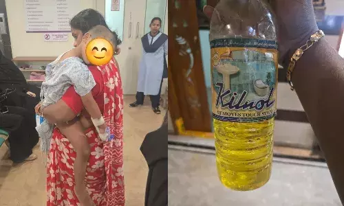 ‘Jealousy over affection’: Aunt allegedly forces 4-year-old to drink acid in Boduppal