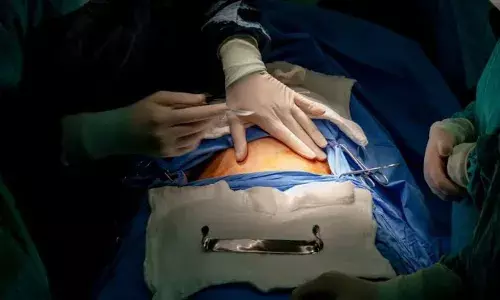 āC-SAFEā: Andhra ties up with UoL, Fernandes Foundation, UNICEF to reduce caesarean deliveries āC-SAFEā: Andhra ties up with UoL, Fernandes Foundation, UNICEF to reduce caesarean deliveries