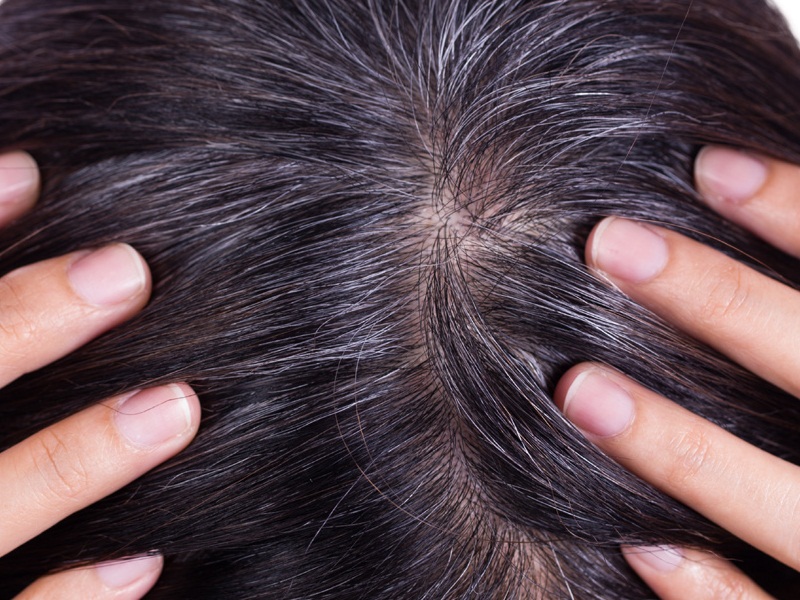 Home Remedies For Gray Hair At Young Age